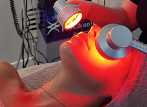 YouEstetik Lazer Epilasyon 4